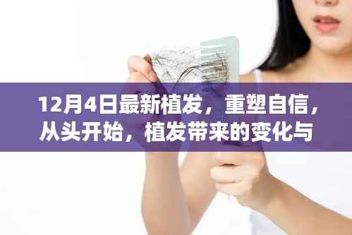 植發(fā)重塑自信，從頭開始的自我重塑之旅
