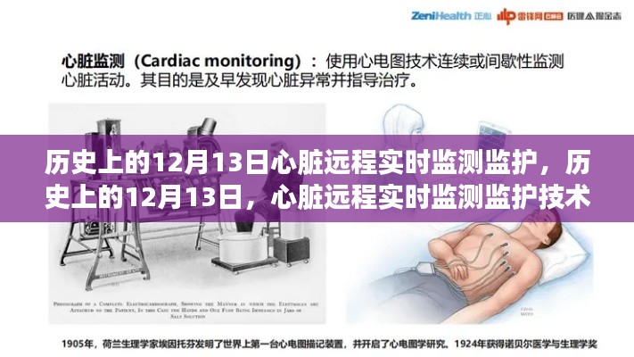 心臟遠程實時監(jiān)測監(jiān)護技術(shù)的歷史性飛躍，紀(jì)念歷史上的十二月十三日里程碑事件