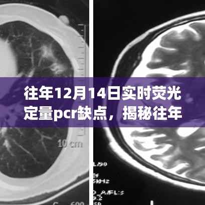 揭秘，歷年12月14日實時熒光定量PCR技術(shù)的三大缺陷分析